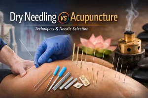The Dry Needling vs Acupuncture Difference & Needle Selection